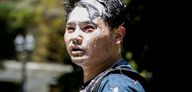 Andy Ngo