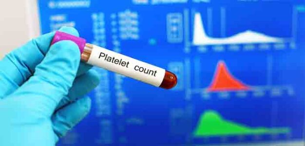 Coronavirus_Platelet_Count