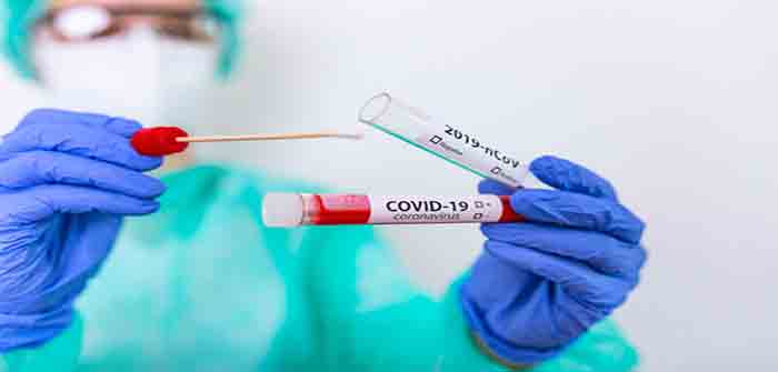 Covid_Coronavirus_shutterstock