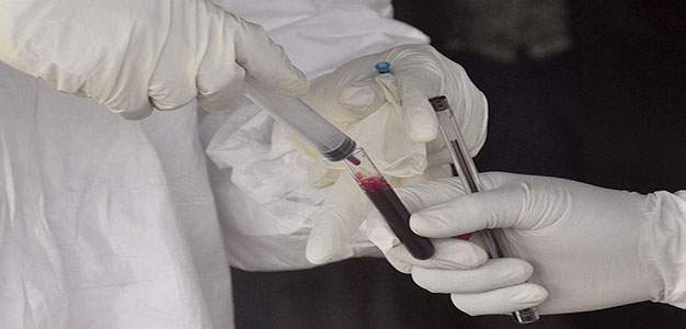Ebola_Vaccine_Russia_Abbas_Dulleh_AP